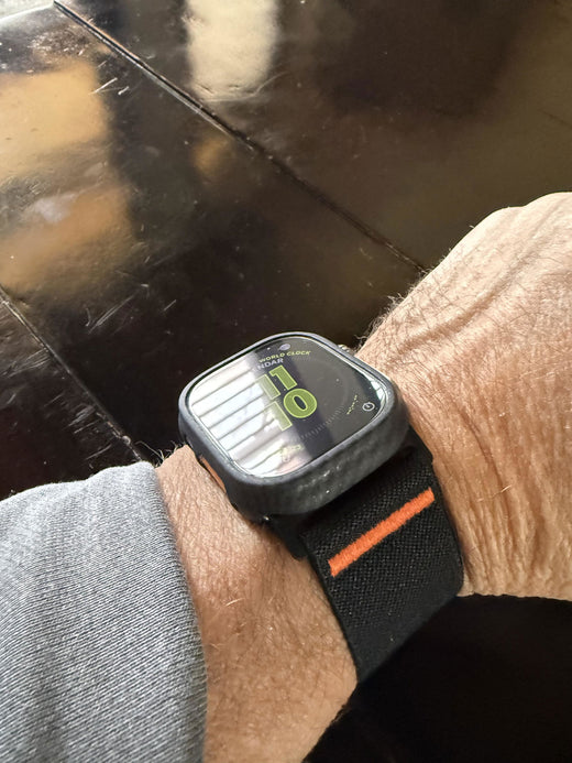 Customer review photo from Anonymous: Active Stretch Band worn on the wrist with an Apple Watch