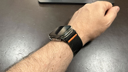 Customer review photo from Toft71: Active Stretch Band worn on the wrist with an Apple Watch